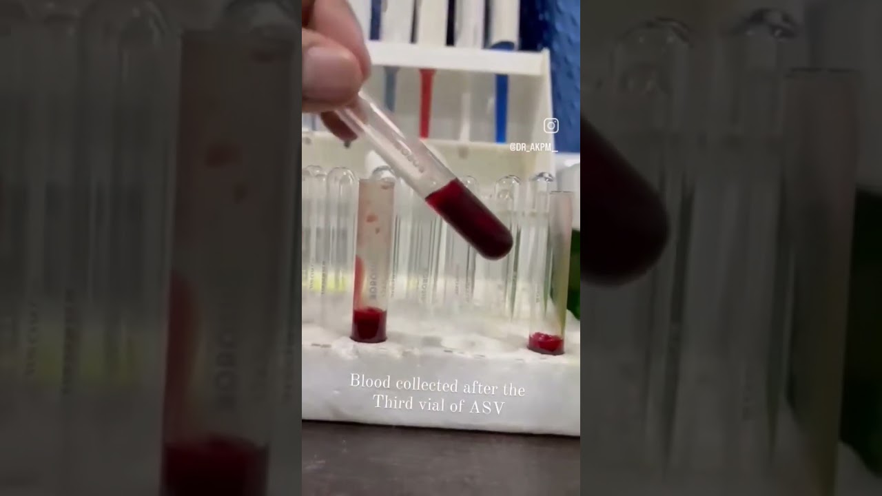 Snake Bite Management in Dogs ! Clotting time? How it works? 