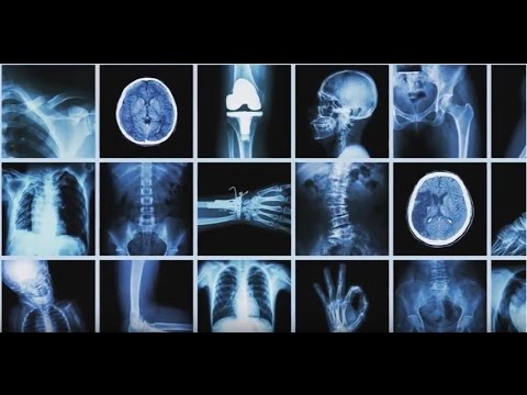 Video: Când ar trebui montate radiografiile?