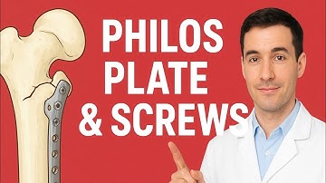 PHILOS Plate & Screws Explained | Proximal Humerus Fracture Fixation