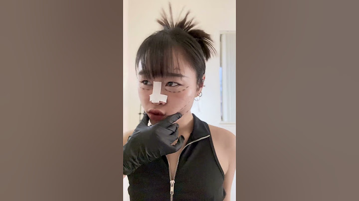 Body shaming - cần câu cơm của Thẩm mỹ viện?🤐 || Nhã Bé Bắp