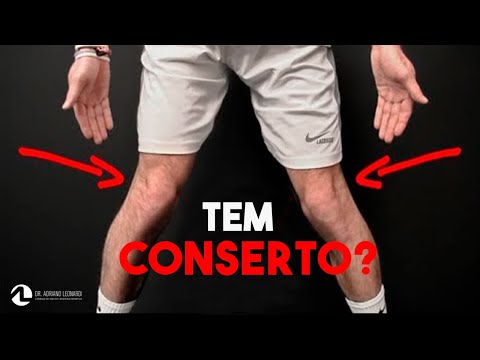 JOELHO VALGO predispõe a condromalacia? TEM CORREÇÃO?