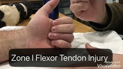 Zone I Flexor Tendon Injury