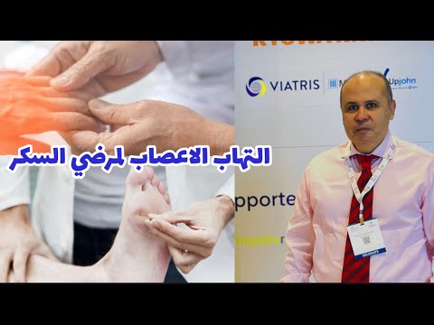 ليه مريض السكر عنده تنميل وخدلان في اليدين والقدمين التهاب الاعصاب الطرفيه