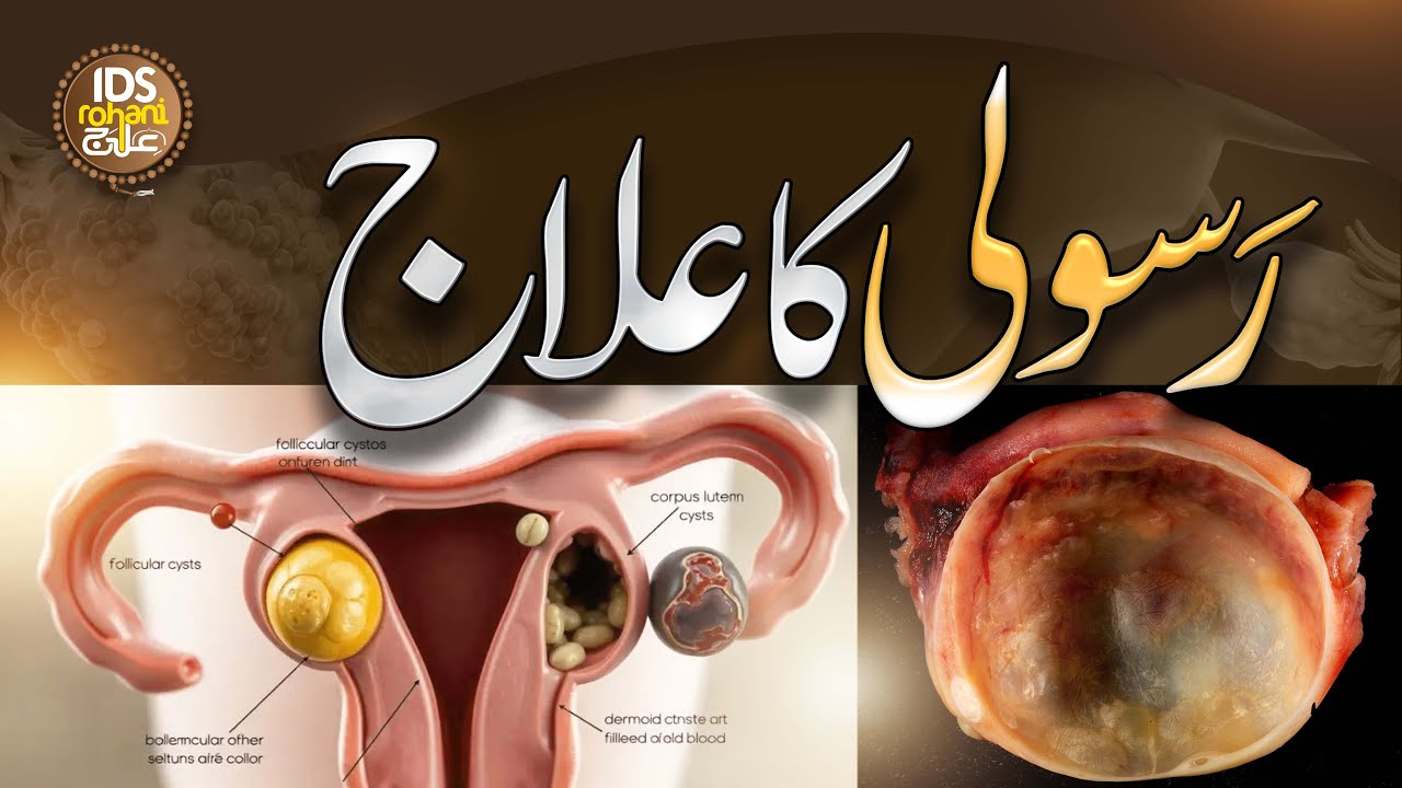 Rasoli Ka Ilaaj | رسولی کا حل | Rasoli Ki Alamat | Rasoli Ka Asan Ilaaj | Mufti Ghulam Dastageer