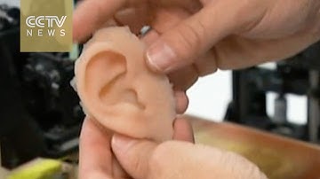 3D-printed prosthetic ears to help kids hear