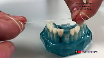 ¿Puedo utilizar hilo dental en mis implantes?