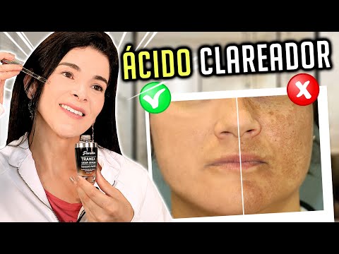 Vídeo: Como você dilui manchas de ácido?