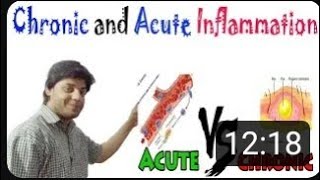 Chronic and acute inflammation (inflammation lecture 3)