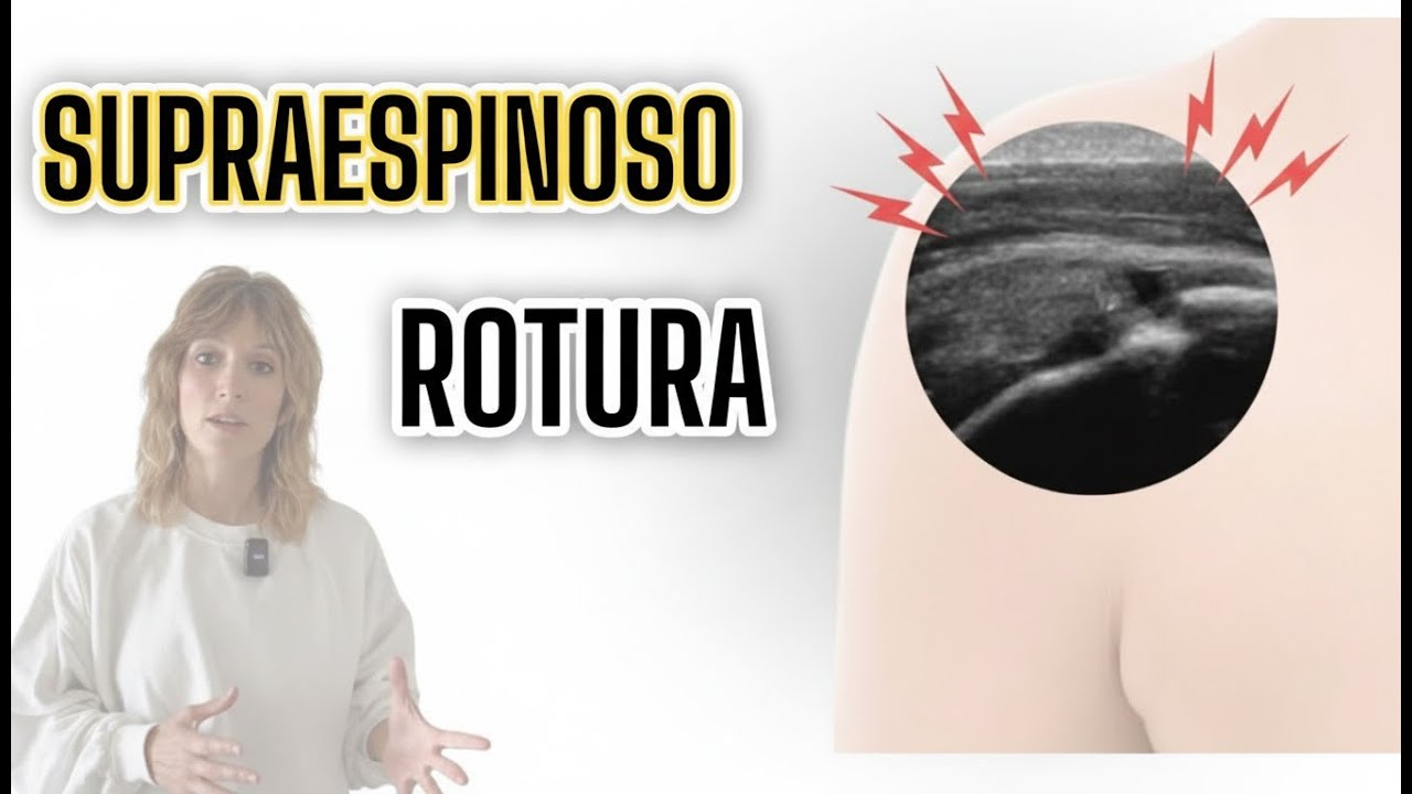 🤩¿CÓMO ver una rotura en el tendón del SUPRAESPINOSO aunque no sepas ecografía?🤩 3 PASOS