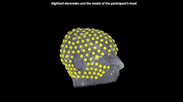 Electrical source imaging with hdEEG