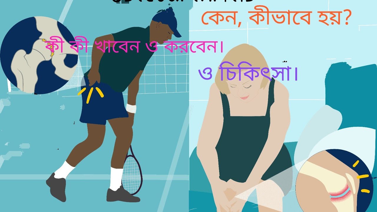 Osteoarthritis treatment in Bengali / বাতের ব্যাথার সমাধান/ bater betha