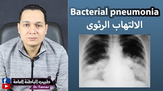 الالتهاب الرئوي البكتيرى / Bacterial pneumonia