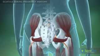 Sciatica during pregnancy Anatomy