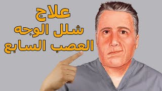 شلل الوجه(العصب السابع )تمارين للعلاج,اهم الاكلات للعلاج ,الاسباب,درجة الاصابه ومدة الاستشفاء