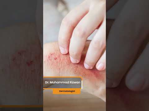 Stop Doing This If You Have Dry - Is Eczema Contagious? #ytshorts #viral  #trending thumbnail image