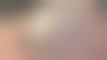 Nandi’s left foot, fat jiggers pulled out - watch full best jigger video @riseupsociety.net