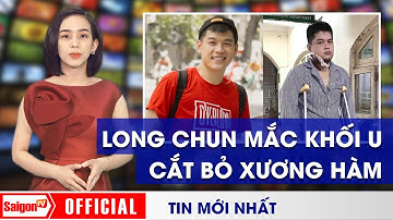 Hot TikToker Long Chun phát hiện KHỐI U NGUY HIỂM ở xương hàm, phải rút khỏi 