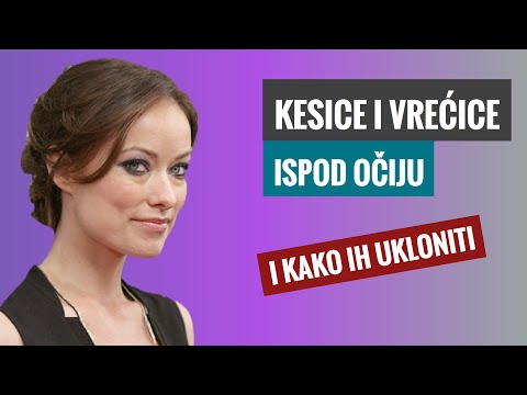 Video: Oticanje Gornjeg I Donjeg Kapka - Zašto Kapci (uzroci) Nateknu Ujutro? Liječenje Edema Kapaka