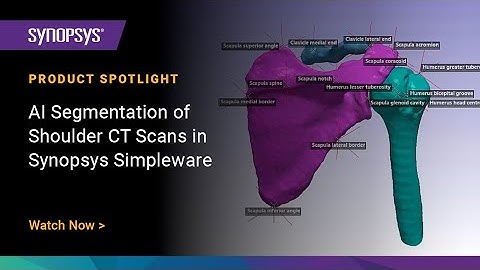 AI Segmentation of Shoulder CT Scans in Synopsys Simpleware