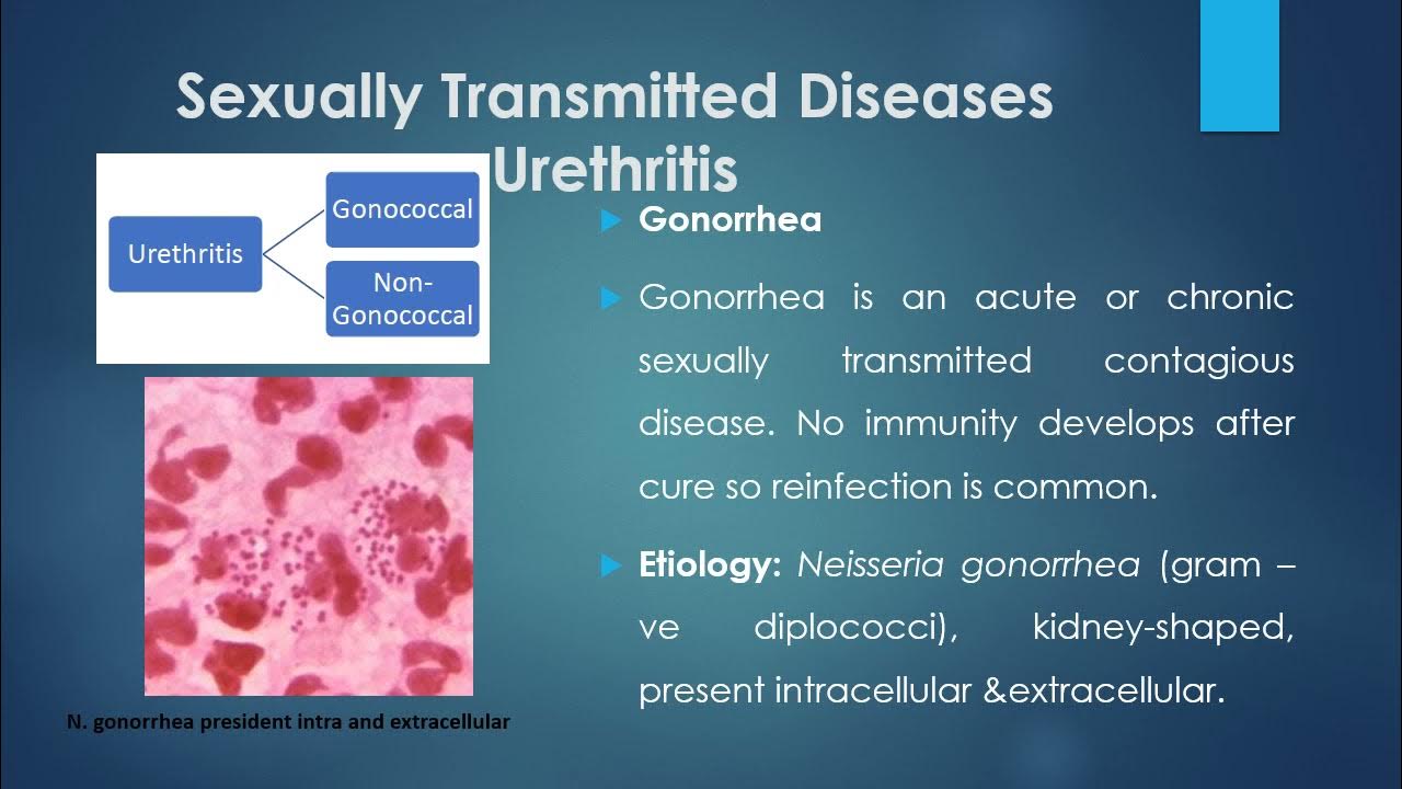 Gonorrhea And Non Gonococcal Urethritis Youtube