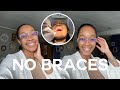 First 48 hours without braces | retainers, eating, brushing, missing my braces | OG Parley