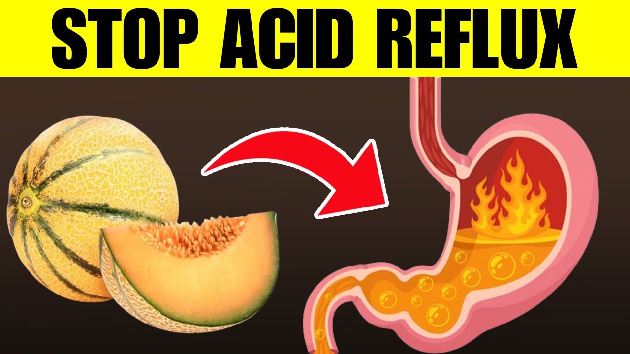 Top 10 Best Foods To Stop Acid Reflux Forever YouTube the-secret-to-stopping-acid-reflux-forever-1-vitamins-revealed