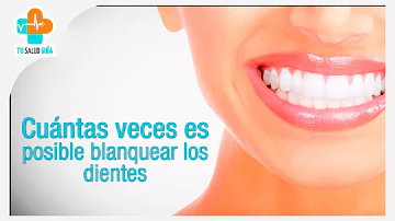 ¿Cuántas veces al año puede blanquearse los dientes?