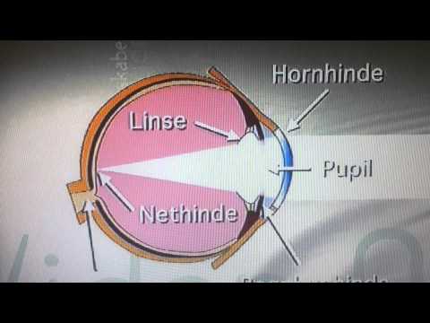 Video: Sådan Slipper Du Af Et Sort øje - 13 Retsmidler + Tip Til Forebyggelse