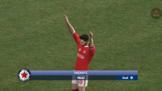 Dream League Soccer 2017 Android Gameplay #17 - Difficult game vs Manchester City screenshot 2