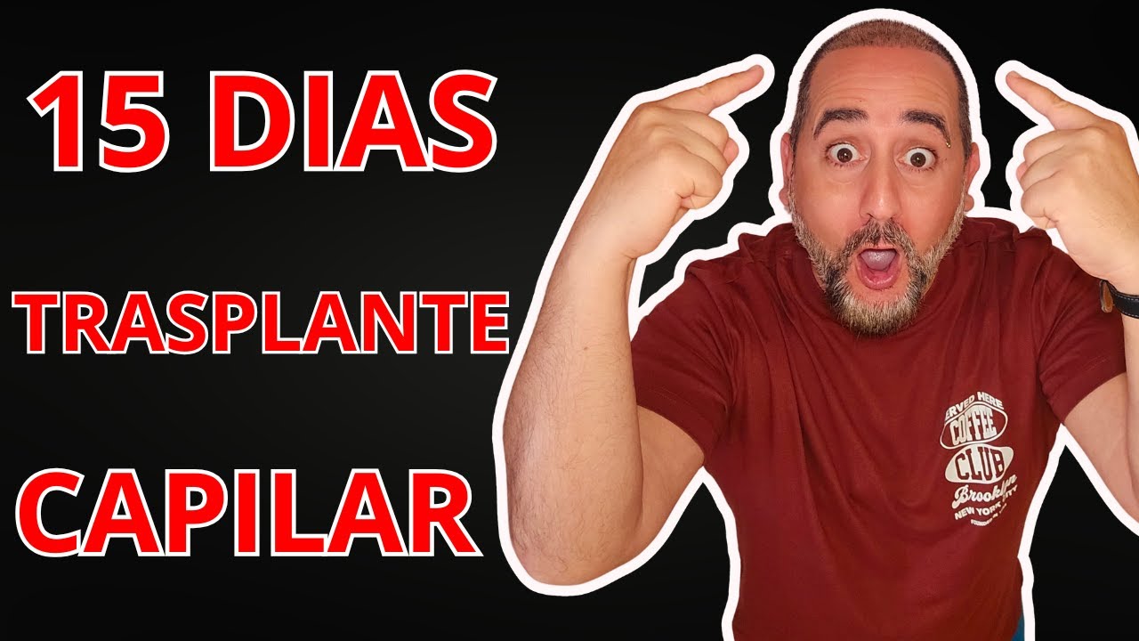 Mi experiencia real con el trasplante capilar en los primeros 15 días