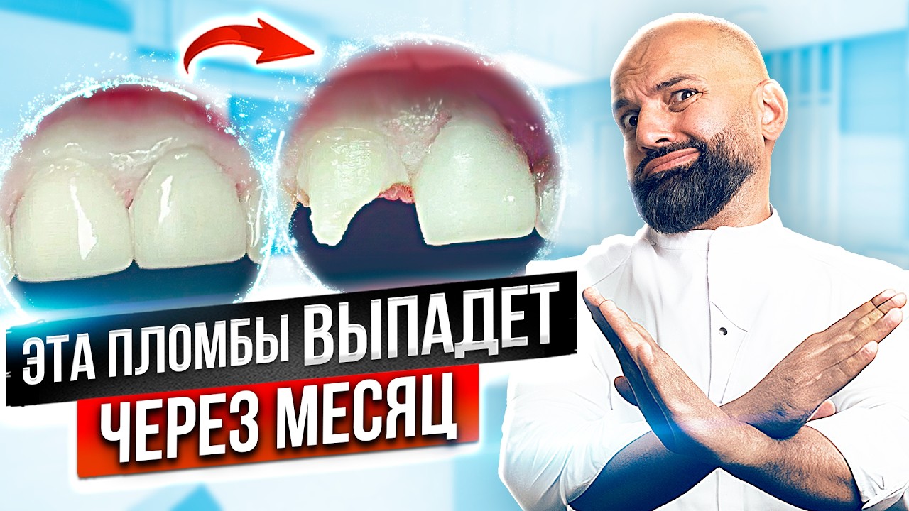 Какая ПЛОМБА лучше? Какие ПЛОМБЫ ВЫПАДУТ быстрее? Как работает зубная ...