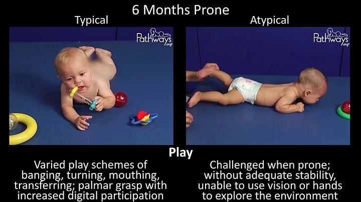 6 Month Old Baby Typical & Atypical Development Side by Side - DayDayNews
