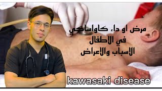 اعراض مرض الكاواساكي Kawasaki والأسباب و المضاعفات