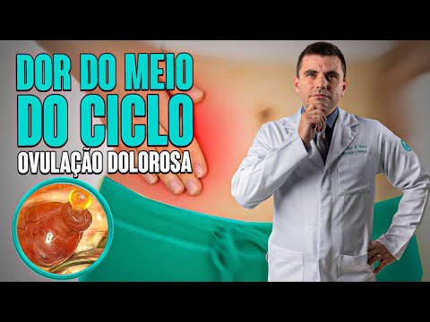 Dor do Meio do Ciclo - Ovulação Dolorosa