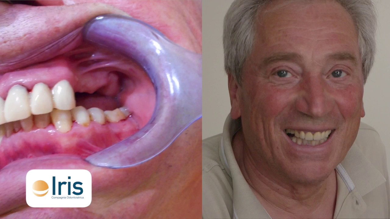 Si, ma quanto costa?!