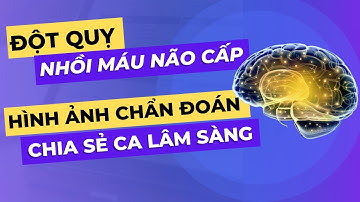 Đột quỵ nhồi máu não cấp: hình ảnh chẩn đoán và ca lâm sàng