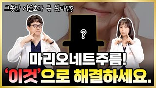 마리오네트주름! 그 동안 여타 리프팅 시술로 효과 없었다면? ‘이것’으로 해결하세요~(feat.셀리뉴리프팅)