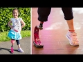 Little Girl at 7 in Her New Prosthetic Leg, Trending