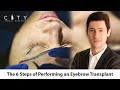 6 Steps Eyebrow Transplant | New York Eyebrow Hair Transplant | UES
