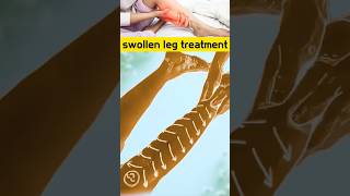 Swollen legs treatment at home #legmassage #swollenlegs