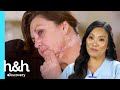 "Mi cuerpo parece un mapa de cicatrices" | Dra. Sandra Lee: Especialista en piel | Discovery H&H