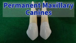 Permanent Maxillary Canine