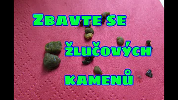 Co jsou nejlepší potraviny pro detoxikaci organismu?