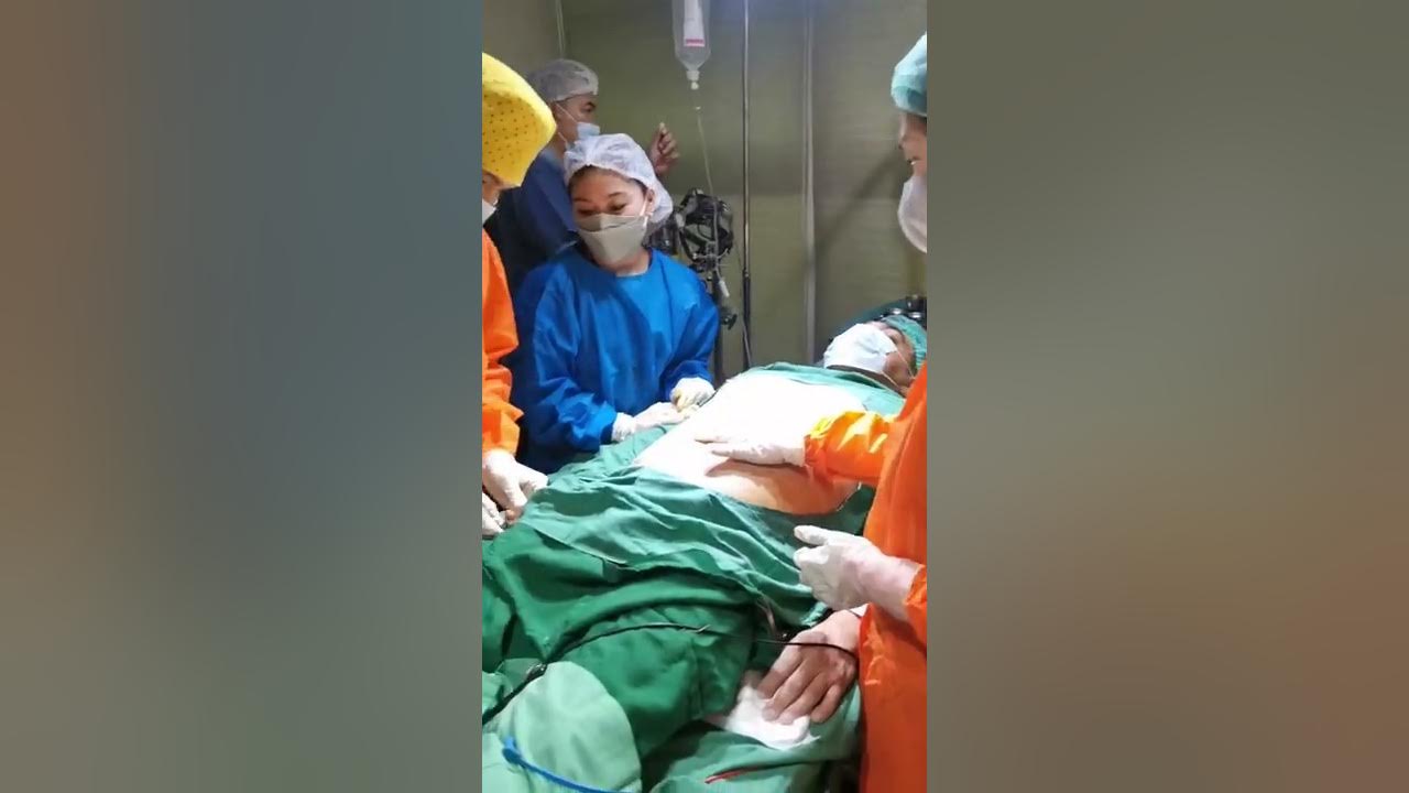 Penile Enhancement with Liposuction of True with glandular