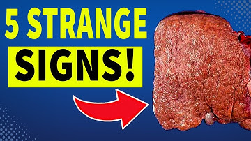5 STRANGE Signs Your Liver Is Crying for Help