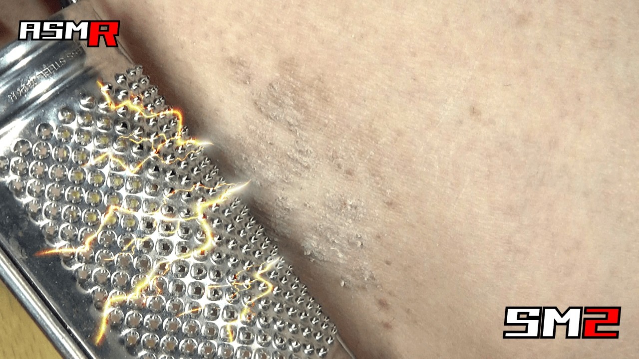 【眠れるアトピー性皮膚炎ASMR】超痒いぶつぶつ（脚）をチーズスライサーで掻く音/癒し/リラックス効果/睡眠導入/マッサージ