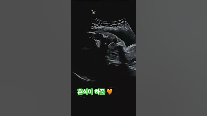 28주 흔식이의 하품ㅋㅋㅋ 목소리 벌써 아빠 닮은 듯? #흔한남매 #냐하 #흔식이