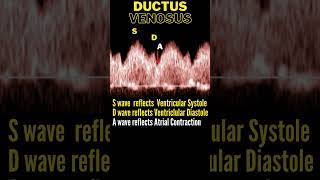 Doppler Ultrasound Ductus Venosus Quick Tips