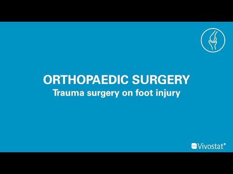 Vivostat used for trauma surgery on foot injury - video from Vivostat
