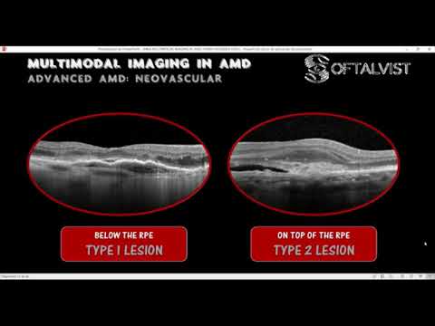 MULTIMODAL IMAGING IN